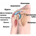 Верховая посадка